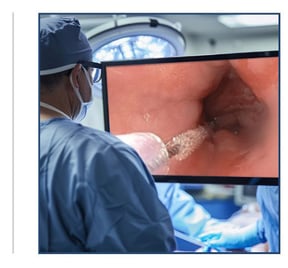 Surg1