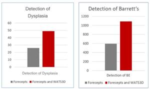 Detection of Dysplasia and Barrett’s Esophagus