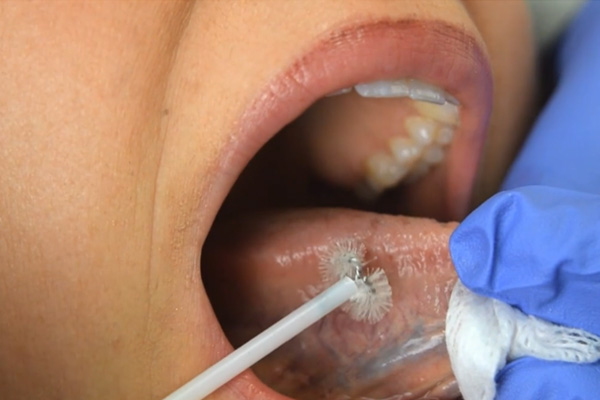 OralCDx-Techniques