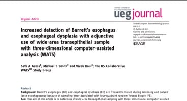 Increased detection of Barrett's esophagus and esophageal dysplasia with adjunctive use of wide-area transepithelial sample with three-dimensional computer-assisted analysis (WATS)