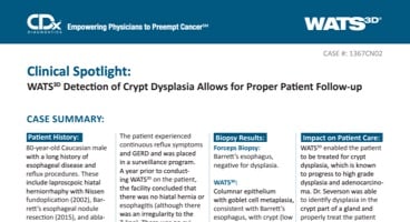 WATS<sup>3D</sup> Detection of Crypt Dysplasia Allows for Proper Patient Follow-up