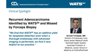 Recurrent Adenocarcinoma Identified by WATS<sup>3D</sup> and Missed by Forceps Biopsy