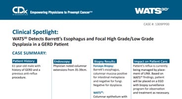 WATS<sup>3D</sup> Detects Barrett's Esophagus and Focal High Grade/Low GradeDysplasia in a GERD Patient