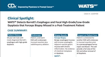 WATS<sup>3D</sup> Detects Barrett's Esophagus and Focal High-Grade/Low-GradeDysplasia that Forceps Biopsy Missed in a Post-Treatment Patient