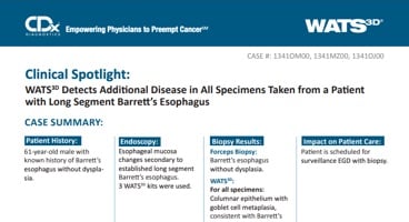 WATS<sup>3D</sup> Detects Additional Disease in All Specimens Taken from a Patientwith Long Segment Barrett's Esophagus