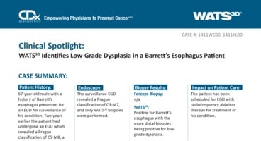 WATS<sup>3D</sup> Identifies Low-Grade Dysplasia in a Barrett's Esophagus Patient