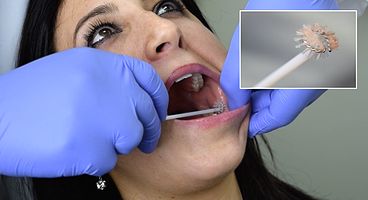 Transepithelial Sampling of woman's mouth